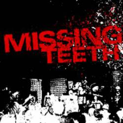Missing Teeth : Missing Teeth